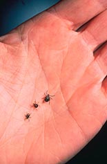 Ticks on a human hand